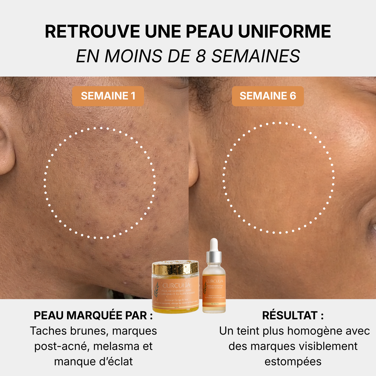 Pads Nettoyants au Curcuma 3 en 1
